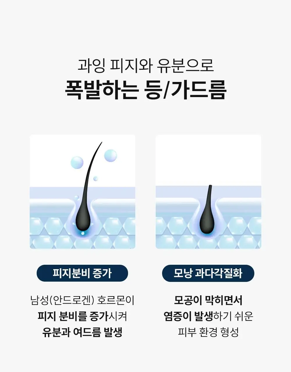[등드름/체취케어] 낫포유 지성피부전용 등드름/가드름 클리어 올인원 바디워시 포맨 500ml 상세페이지 6